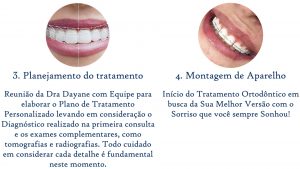 Descubra como transformar seu sorriso com Ortodontia em 4 passos