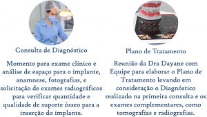 implantes dentários